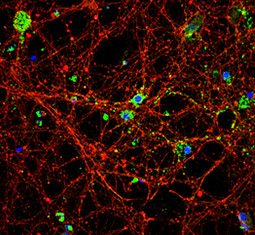5-HT1A receptor antibody [N3C1], Internal GTX104703